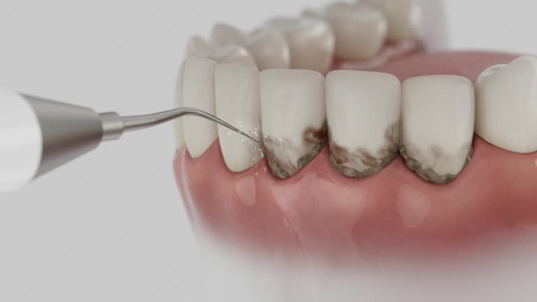 Reliable Dental Implants contractor in Moline Acres, MO by Smile Center Dentistry